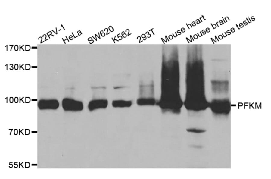 Anti-PFKM Antibody from Bioworld Technology (BS7596) - Antibodies.com
