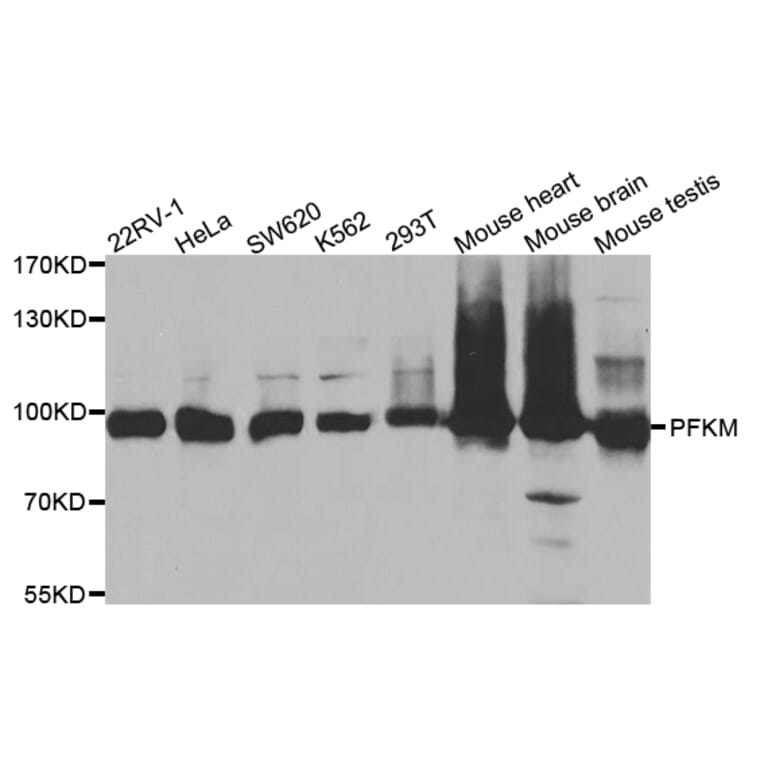 Anti-PFKM Antibody from Bioworld Technology (BS7596) - Antibodies.com