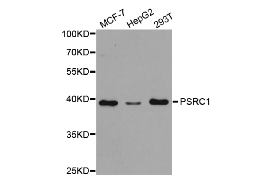 Anti-PSRC1 Antibody from Bioworld Technology (BS7598) - Antibodies.com