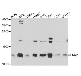 Anti-SNRPE Antibody from Bioworld Technology (BS7602) - Antibodies.com