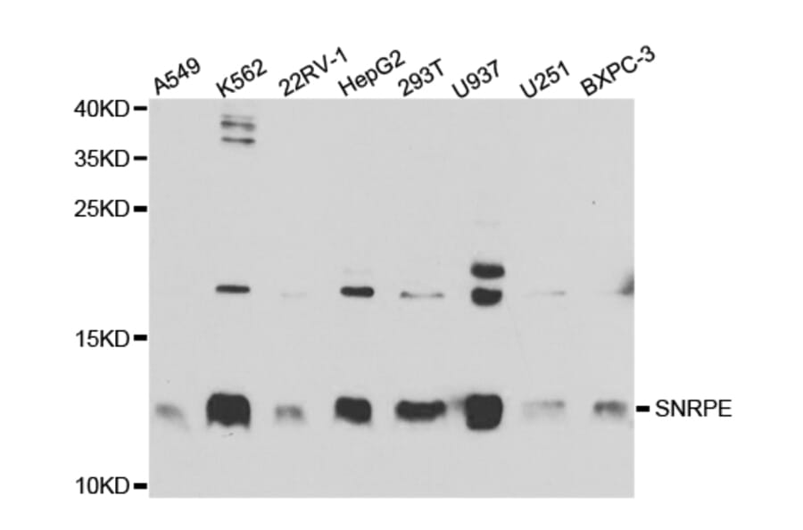 Anti-SNRPE Antibody from Bioworld Technology (BS7602) - Antibodies.com