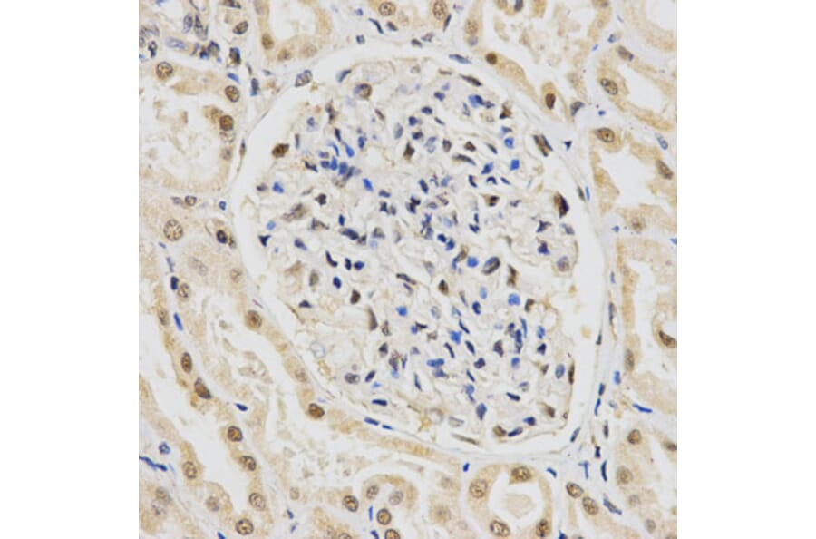 Anti-SNRPE Antibody from Bioworld Technology (BS7602) - Antibodies.com
