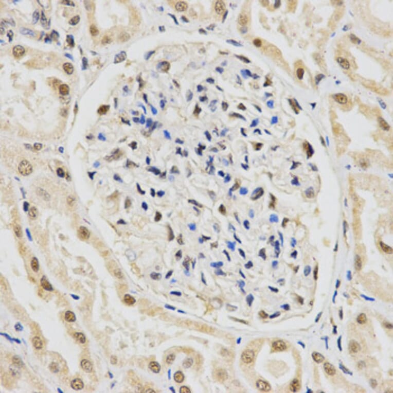 Anti-SNRPE Antibody from Bioworld Technology (BS7602) - Antibodies.com