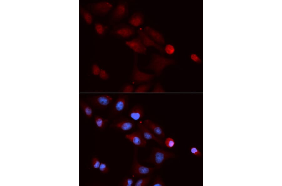Anti-SNRPE Antibody from Bioworld Technology (BS7602) - Antibodies.com