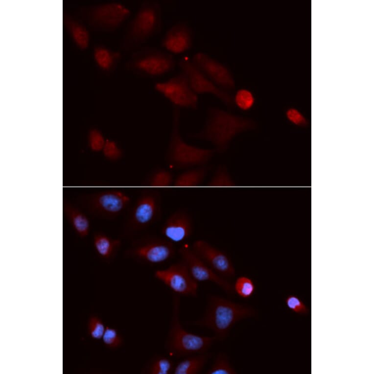 Anti-SNRPE Antibody from Bioworld Technology (BS7602) - Antibodies.com