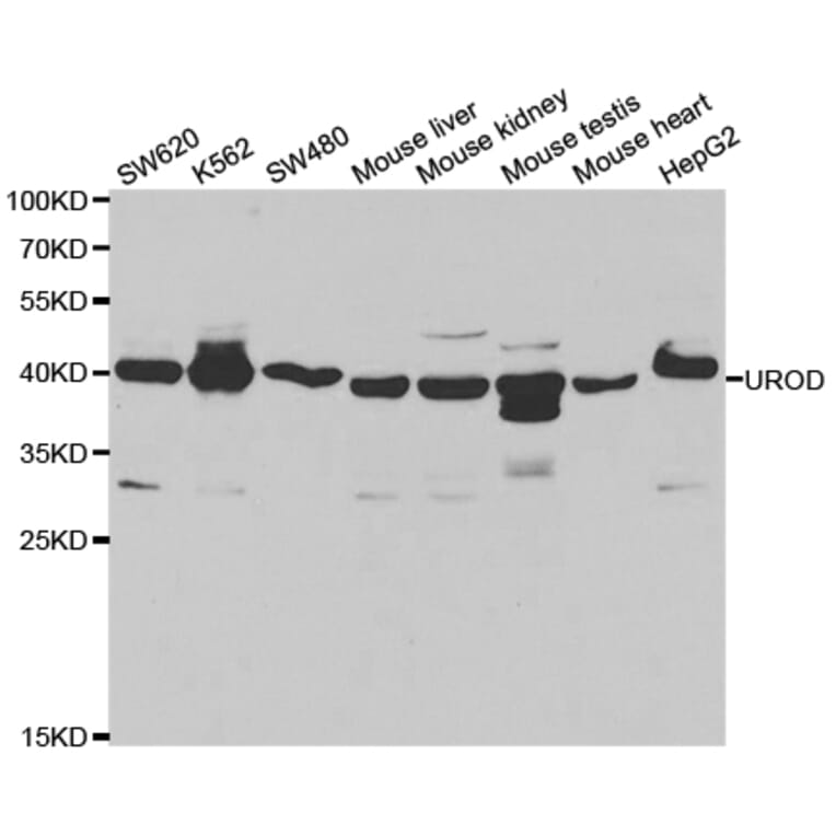 Anti-UROD Antibody from Bioworld Technology (BS7604) - Antibodies.com