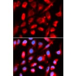 Anti-UROD Antibody from Bioworld Technology (BS7604) - Antibodies.com