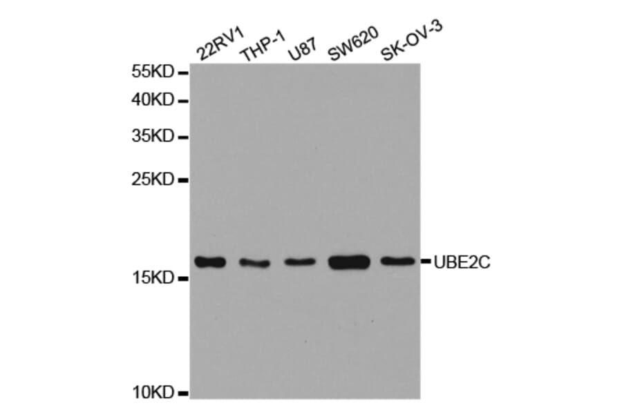 Anti-UBE2C Antibody from Bioworld Technology (BS7608) - Antibodies.com