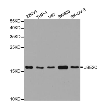 Anti-UBE2C Antibody from Bioworld Technology (BS7608) - Antibodies.com