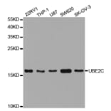 Anti-UBE2C Antibody from Bioworld Technology (BS7608) - Antibodies.com