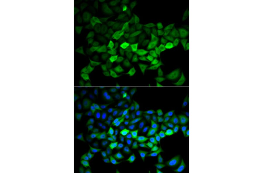 Anti-UBE2C Antibody from Bioworld Technology (BS7608) - Antibodies.com