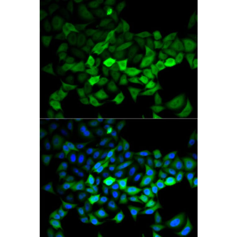 Anti-UBE2C Antibody from Bioworld Technology (BS7608) - Antibodies.com