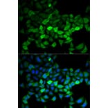 Anti-UBE2C Antibody from Bioworld Technology (BS7608) - Antibodies.com