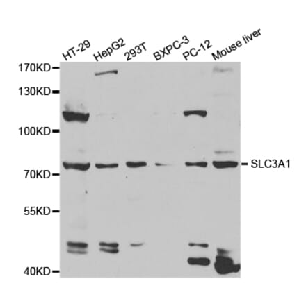Anti-SLC3A1 Antibody from Bioworld Technology (BS7609) - Antibodies.com