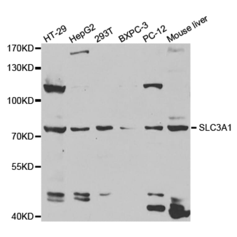 Anti-SLC3A1 Antibody from Bioworld Technology (BS7609) - Antibodies.com