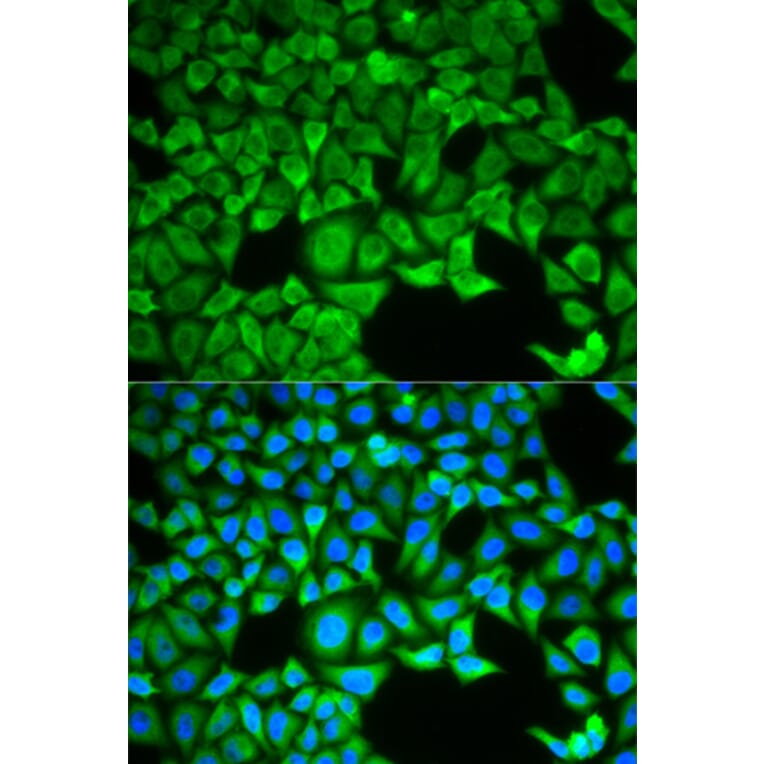 Anti-SLC3A1 Antibody from Bioworld Technology (BS7609) - Antibodies.com