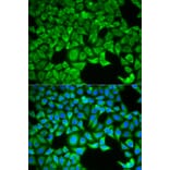 Anti-SLC3A1 Antibody from Bioworld Technology (BS7609) - Antibodies.com