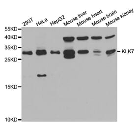 Anti-KLK7 Antibody from Bioworld Technology (BS7611) - Antibodies.com