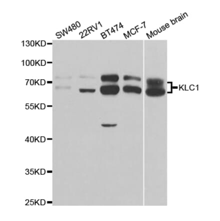 Anti-KLC1 Antibody from Bioworld Technology (BS7616) - Antibodies.com