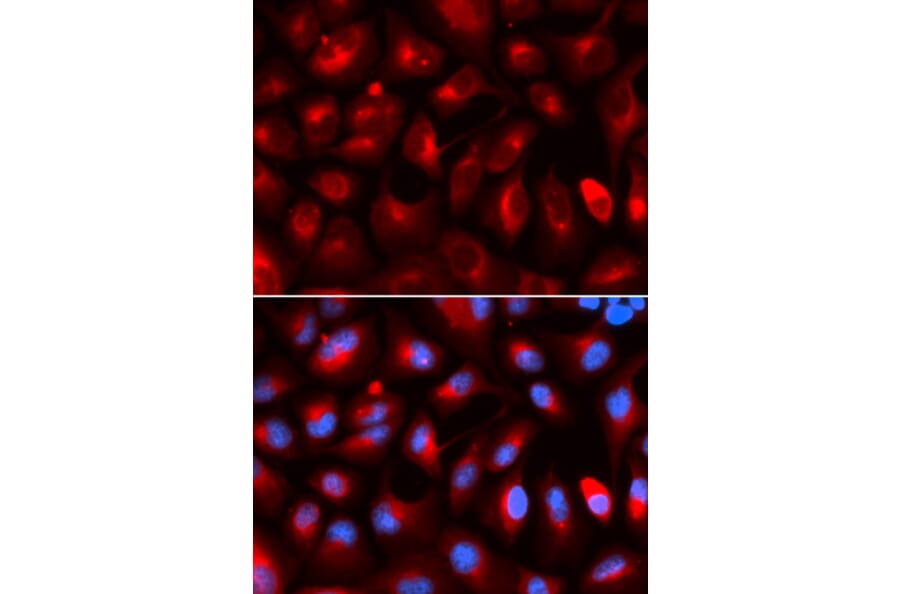 Anti-KLC1 Antibody from Bioworld Technology (BS7616) - Antibodies.com