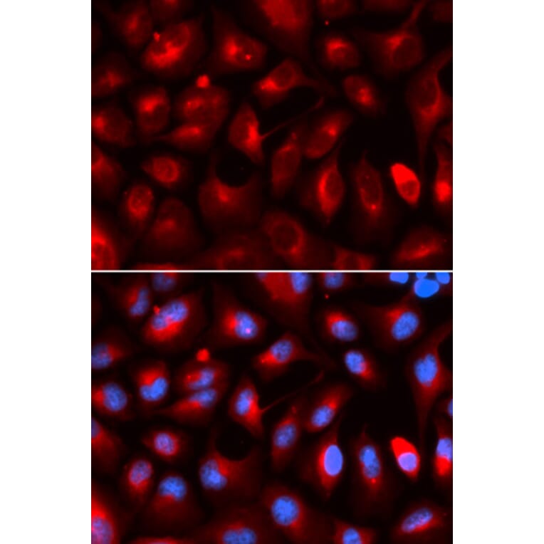 Anti-KLC1 Antibody from Bioworld Technology (BS7616) - Antibodies.com