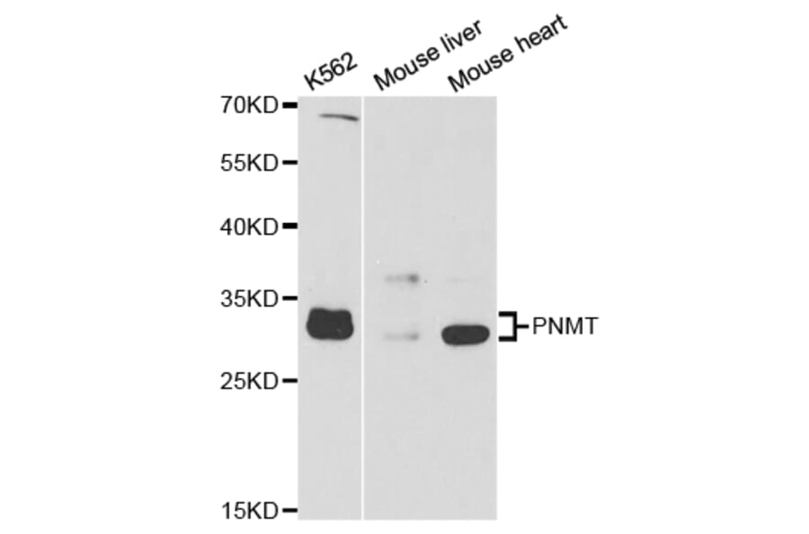Anti-PNMT Antibody from Bioworld Technology (BS7617) - Antibodies.com