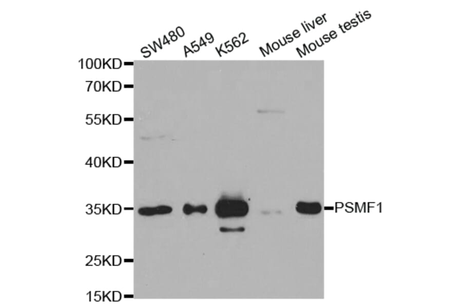 Anti-PSMF1 Antibody from Bioworld Technology (BS7618) - Antibodies.com