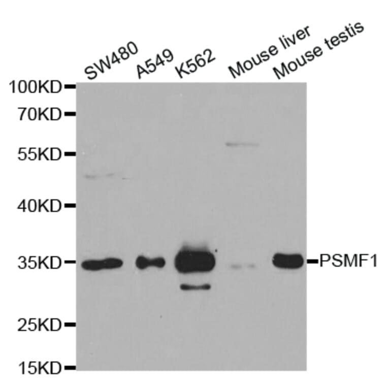 Anti-PSMF1 Antibody from Bioworld Technology (BS7618) - Antibodies.com