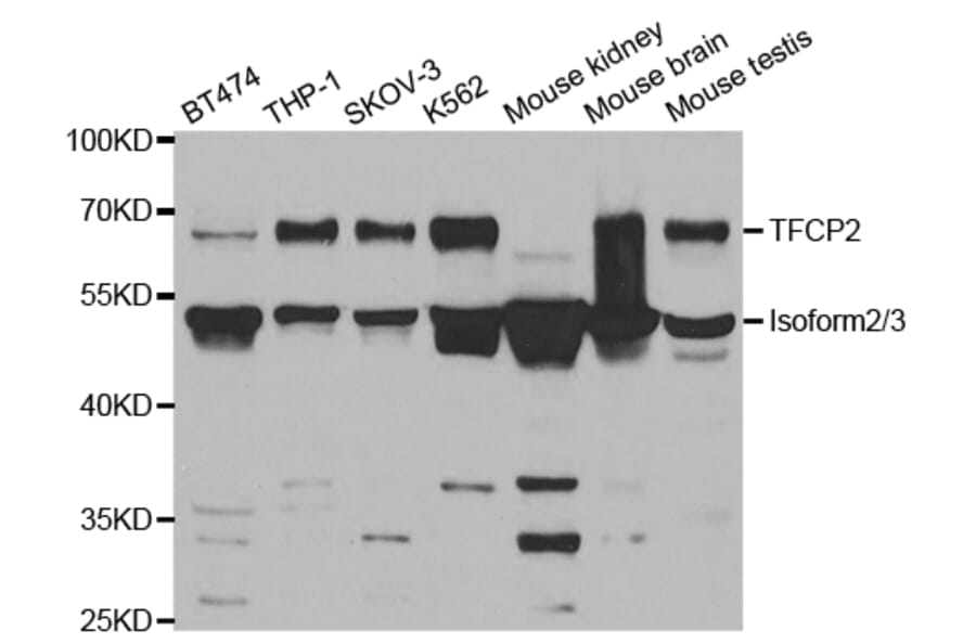 Anti-TFCP2 Antibody from Bioworld Technology (BS7619) - Antibodies.com