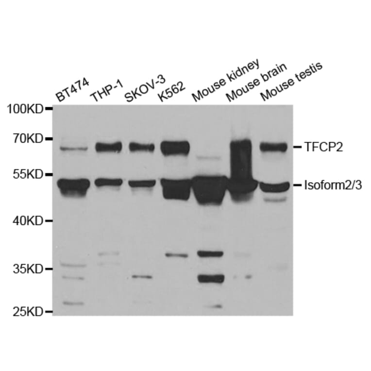 Anti-TFCP2 Antibody from Bioworld Technology (BS7619) - Antibodies.com