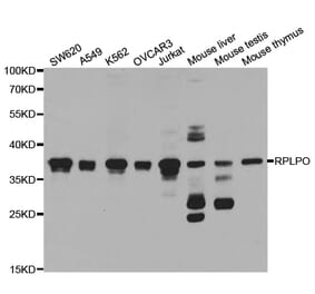 Anti-RPLP0 Antibody from Bioworld Technology (BS7620) - Antibodies.com