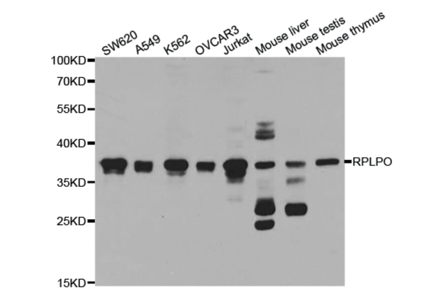 Anti-RPLP0 Antibody from Bioworld Technology (BS7620) - Antibodies.com