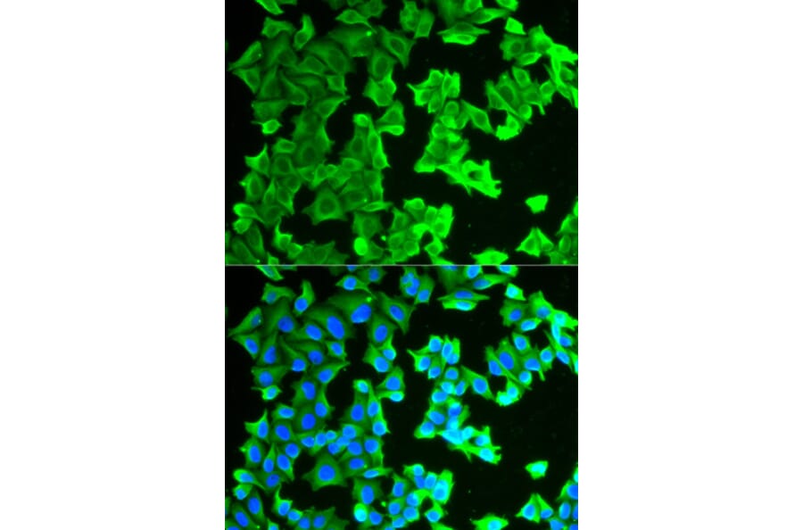 Anti-RPLP0 Antibody from Bioworld Technology (BS7620) - Antibodies.com
