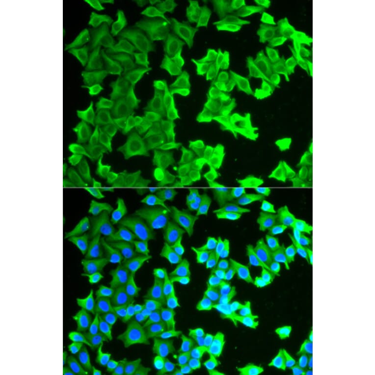 Anti-RPLP0 Antibody from Bioworld Technology (BS7620) - Antibodies.com