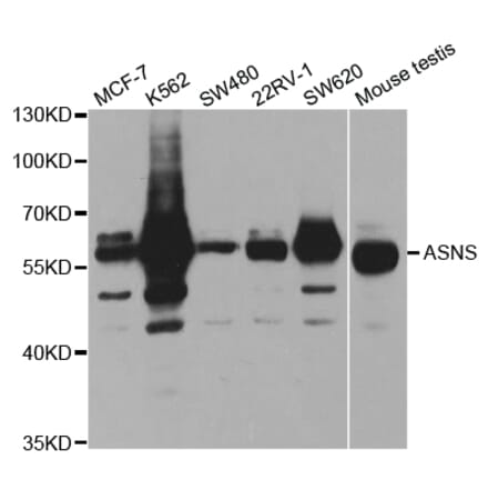 Anti-ASNS Antibody from Bioworld Technology (BS7621) - Antibodies.com
