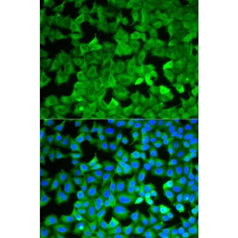 Anti-ASNS Antibody from Bioworld Technology (BS7621) - Antibodies.com