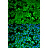 Anti-ASNS Antibody from Bioworld Technology (BS7621) - Antibodies.com