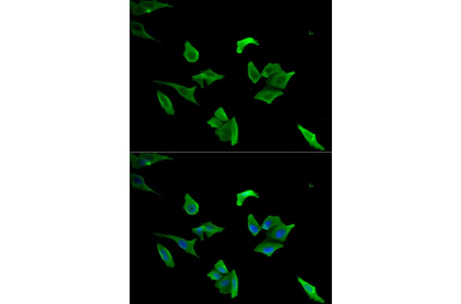 Anti-LCP1 Antibody from Bioworld Technology (BS7623) - Antibodies.com