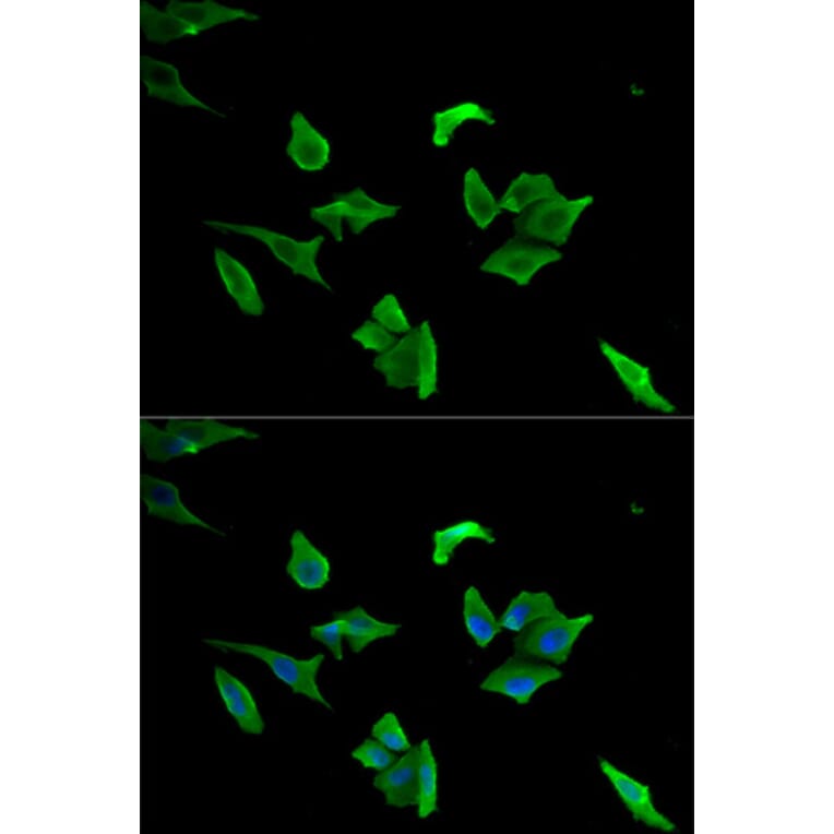 Anti-LCP1 Antibody from Bioworld Technology (BS7623) - Antibodies.com
