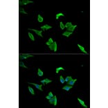 Anti-LCP1 Antibody from Bioworld Technology (BS7623) - Antibodies.com