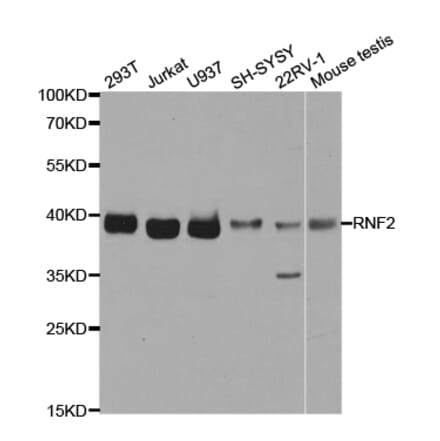 Anti-RNF2 Antibody from Bioworld Technology (BS7624) - Antibodies.com