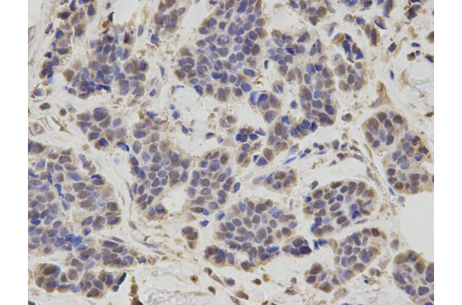 Anti-RNF2 Antibody from Bioworld Technology (BS7624) - Antibodies.com