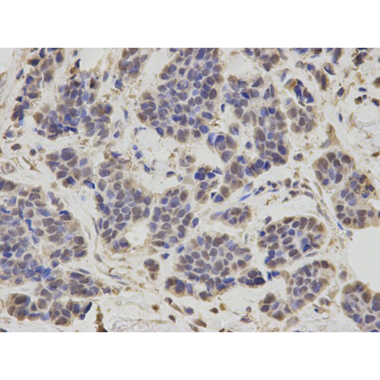 Anti-RNF2 Antibody from Bioworld Technology (BS7624) - Antibodies.com