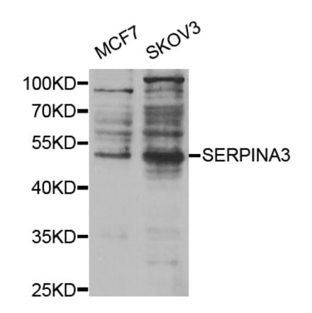 Anti-SERPINA3 Antibody from Bioworld Technology (BS7626) - Antibodies.com