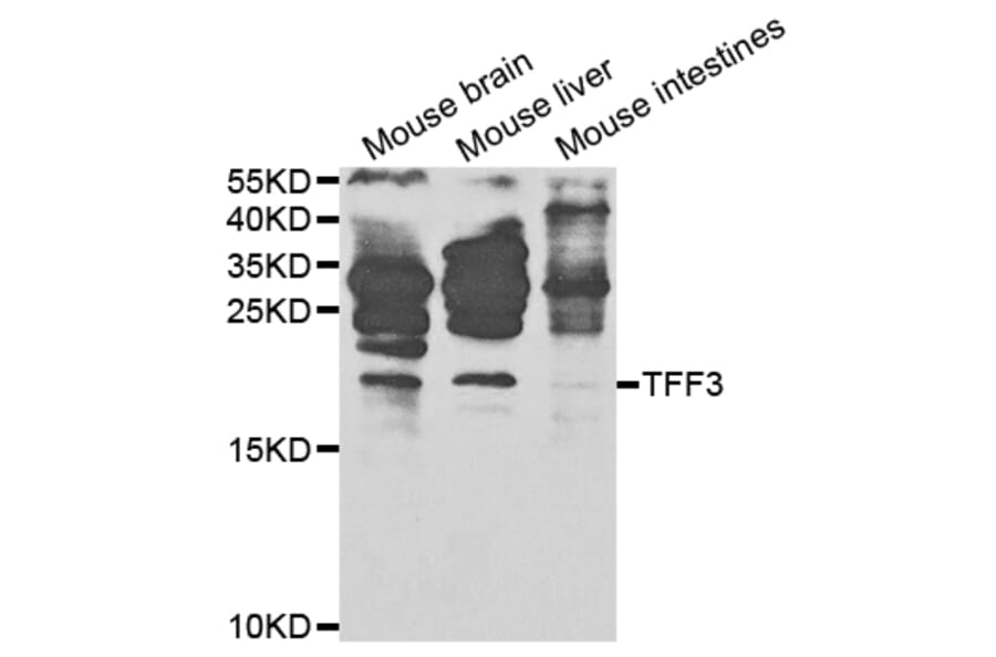 Anti-TFF3 Antibody from Bioworld Technology (BS7627) - Antibodies.com