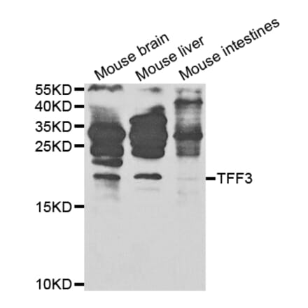 Anti-TFF3 Antibody from Bioworld Technology (BS7627) - Antibodies.com