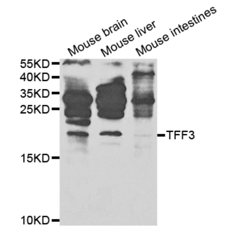 Anti-TFF3 Antibody from Bioworld Technology (BS7627) - Antibodies.com