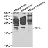 Anti-TFF3 Antibody from Bioworld Technology (BS7627) - Antibodies.com