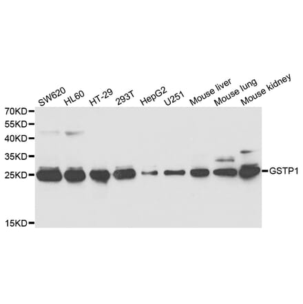 Anti-GSTP1 Antibody from Bioworld Technology (BS7629) - Antibodies.com