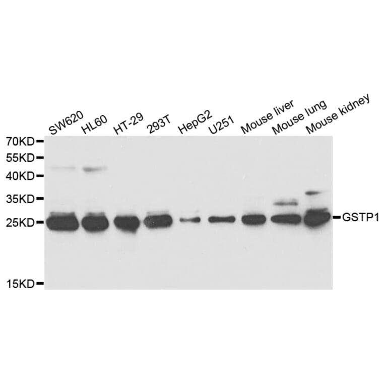 Anti-GSTP1 Antibody from Bioworld Technology (BS7629) - Antibodies.com